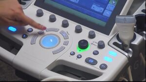 GE LOGIQ P9 Ultrasound Machine Bangladesh