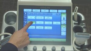GE LOGIQ P9 XDclear Ultrasound System